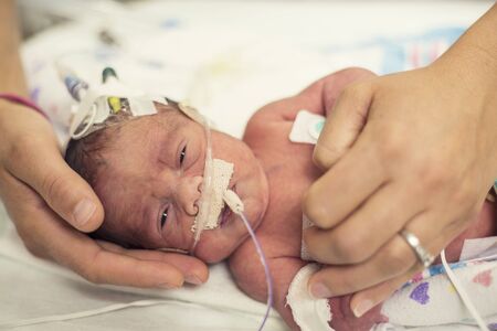 Newborn premature baby in the NICU intensive careの写真素材