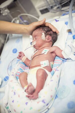 Newborn premature baby in the NICU intensive careの写真素材