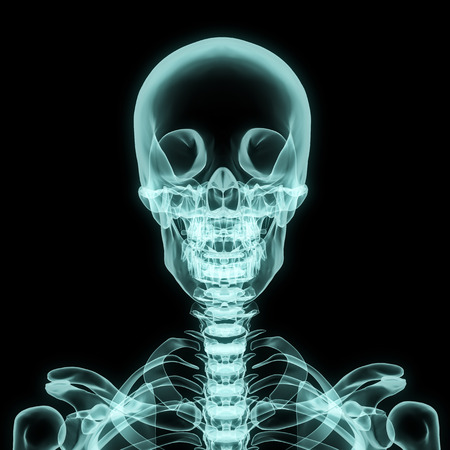 X-ray upper chest included skull in brightness blue with black background