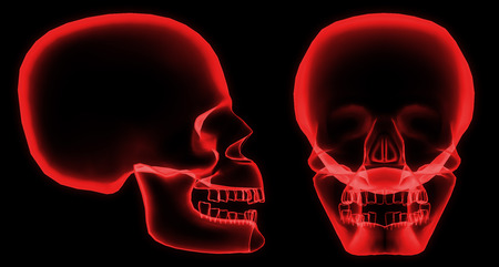 X-ray front and side skull in  red with black backgroundの写真素材