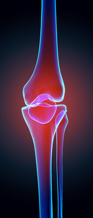 Knee painful - skeleton x-ray, 3D Illustration medical concept.の写真素材