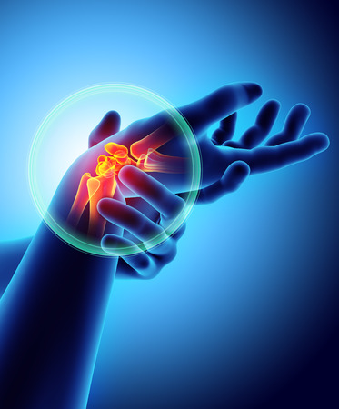Wrist painful - skeleton x-ray, 3D Illustration medical concept.の写真素材