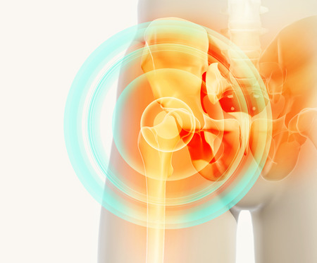 3D illustration, hip painful skeleton x-ray, medical concept.の写真素材