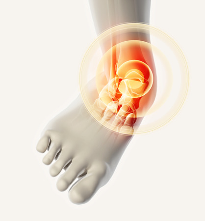 Ankle painful - skeleton x-ray, 3D Illustration medical concept.の写真素材