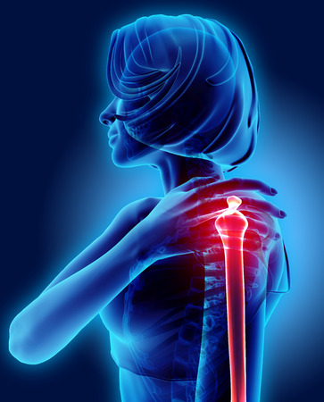 3D illustration, shoulder painful skeleton x-ray, medical concept.の写真素材