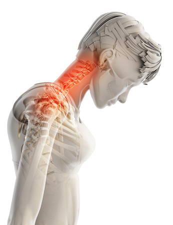 3D illustration, neck painful - cervical spine skeleton x-ray, medical concept.の写真素材