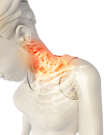 3D illustration, neck painful - cervical spine skeleton x-ray, medical concept.の写真素材