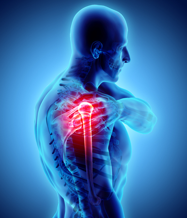 3D illustration, shoulder painful skeleton x-ray, medical concept.の写真素材