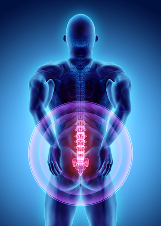 3D Illustration of sacral spine painful, medical concept.の写真素材