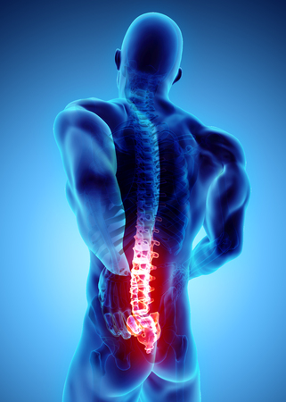 3D Illustration of sacral spine painful, medical concept.の写真素材