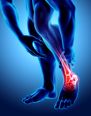 Ankle painful - skeleton x-ray, 3D Illustration medical concept.の写真素材