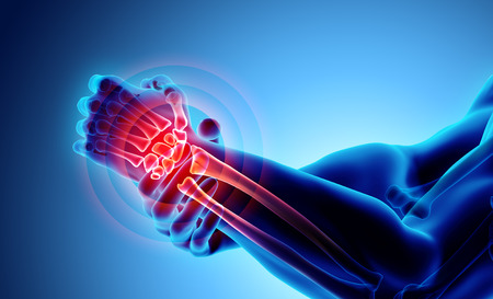 Wrist painful - skeleton x-ray, 3D Illustration medical concept.の写真素材