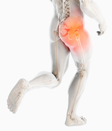3D illustration, hip painful skeleton x-ray, medical concept.の写真素材