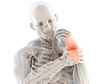 Wrist painful - skeleton x-ray, 3D Illustration medical concept.の写真素材
