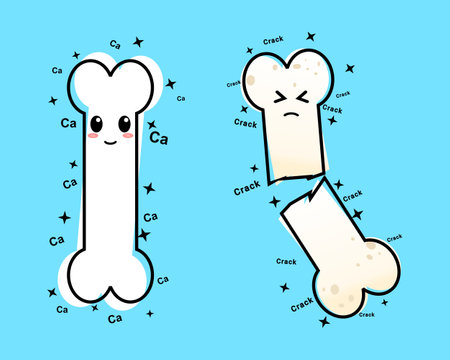 Healthy happy bone and sick sad unhealthy osteoporotic bone, fracture. Illustration vector