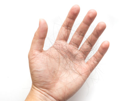 Hairs on a hand, hair fall, hair loss, serious problem.の写真素材