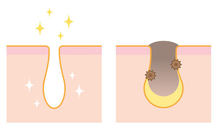 Clogged pores and clean pores on nose.のイラスト素材