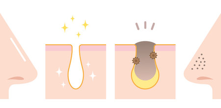 Clogged pores and clean pores on nose.のイラスト素材