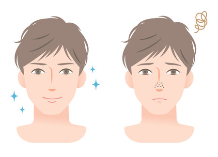 Clogged pores and clean pores on nose of young men's face. before and after mens skin care beauty conceptのイラスト素材