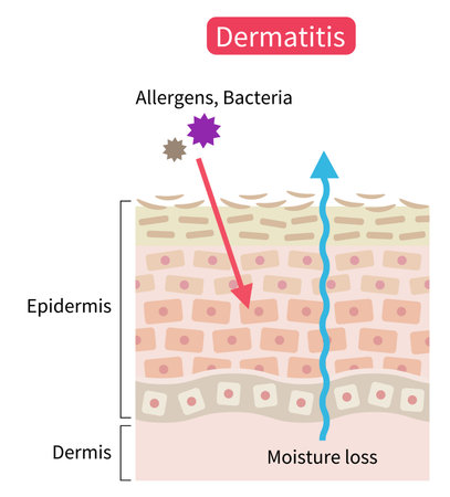 atopic dermatitis (eczema) dry skin disrupt moisture barrier that allows penetrate external stimuli. Healthy skin care conceptのイラスト素材