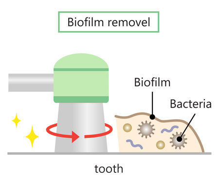 dental biofilms removal illustration. dental health and oral care conceptのイラスト素材