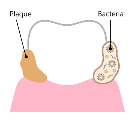bacteria and plaque attachment on tooth. Initial dental biofilm illustration. dental health and oral care conceptのイラスト素材