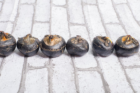 Talipes equinovarusの写真素材