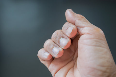 Dry man's fingers and nails dirty with gray background.の写真素材