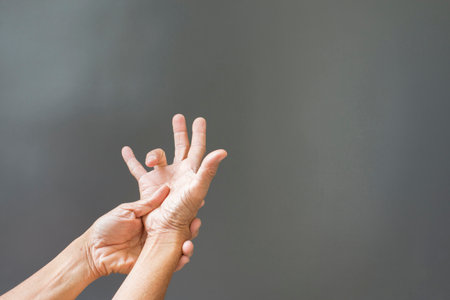 Hands and bones, rheumatoid fingers with inflammatory problems On a gray backgroundの写真素材