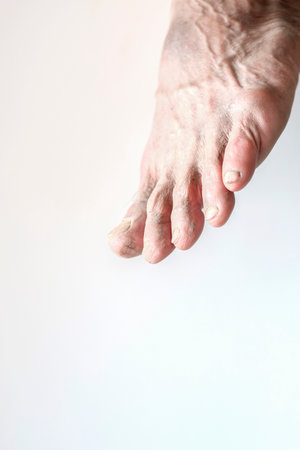 Rough feet Of an elderly man on a white background