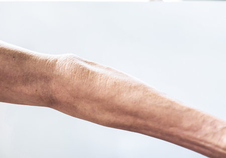 The arms of an elderly person with irregular shapes on an empty white spaceの写真素材