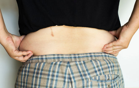 Individual postures show the back muscles that have subcutaneous fat around the waist.の写真素材