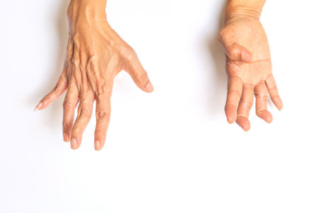 A person's finger has a spasm and muscle spasmsの写真素材