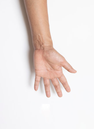 Image of hand and finger gestures of an elderly person with muscle spasmの写真素材
