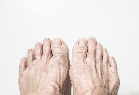 Rough wrinkled feet of an elderly man on a white background