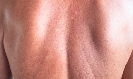 Problem skin rash from allergy symptoms.