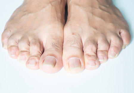 image of hair on human toesの写真素材