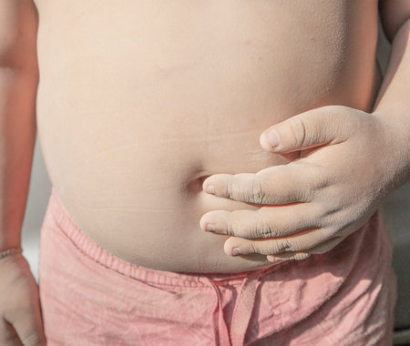 Body shape of obese childrenの写真素材