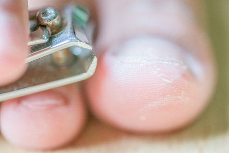 To cut the nails to the toes of the boys Cut to short nails and dry skin to peel.の写真素材