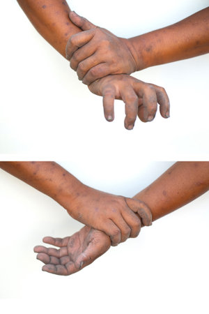 Hand gestures, joint pain, dirty bones on a white backgroundの写真素材