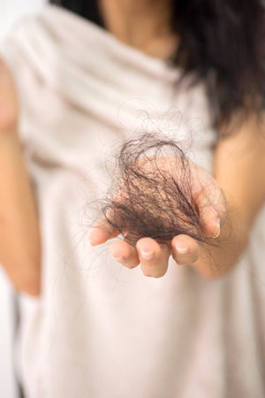 long hair woman with hair lossの写真素材