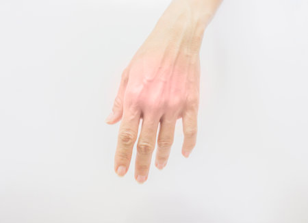 Human hand with muscle problems, inflammation, pain and swelling.の写真素材