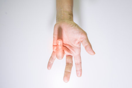 Pain and inflammation of the surrounding muscles and bones Wrist and fingers, health and medical conceptの写真素材