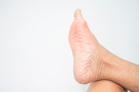 Person bare feet , health and medical conceptの写真素材