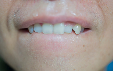 close up of person with a smile having sharp teeth
