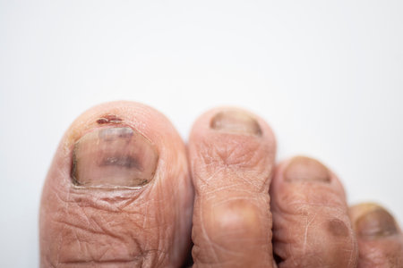 Pedicure that has problems of physical healthの写真素材