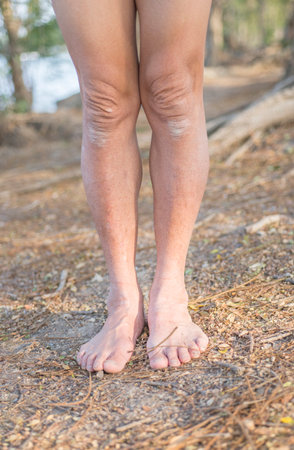 Osteoarthritis of the legs and knees of the elderly with degenerative musculoskeletal inflammation. Dry and wrinkled skinの写真素材