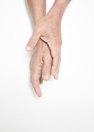 Fingers of elderly people with symptoms of muscle and joint problems, bone marrowの写真素材