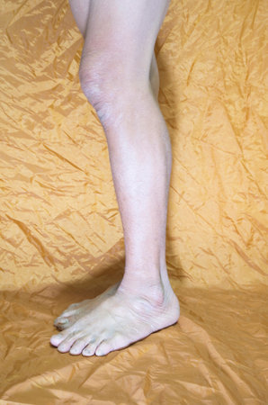 The muscles of the lower part of the body on the older person's legsの写真素材
