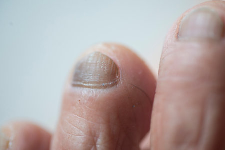 Toenails and toes Dry and rough skin. Older people.